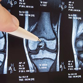 knee pain treatment reno, sports recovery reno, covid-19 protocols